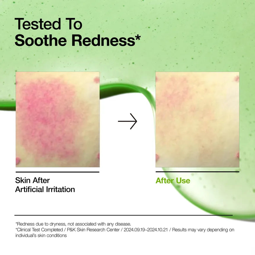 Before and after comparison of skin redness with a green background and text about soothing redness.