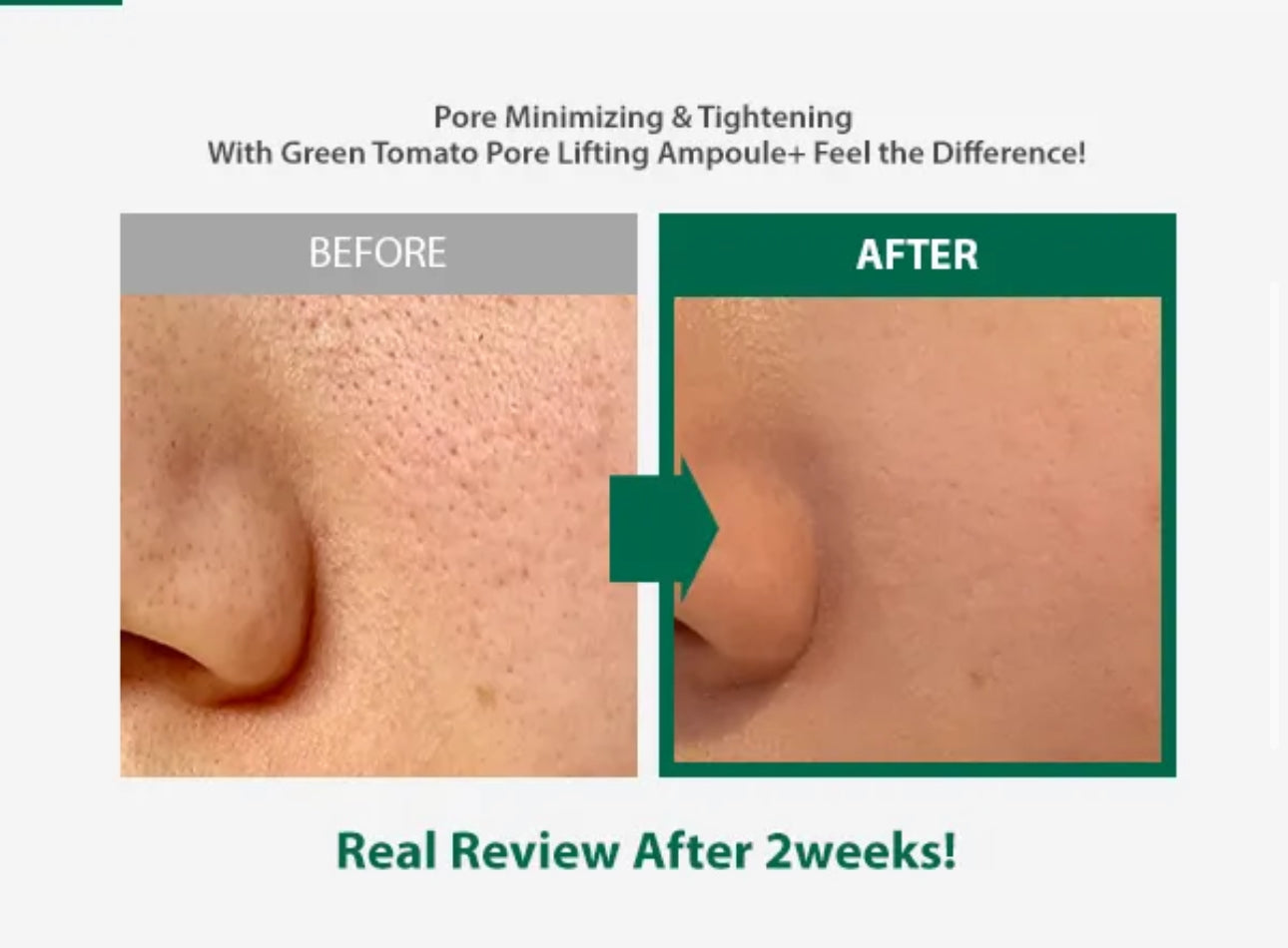 Before and after comparison of skin texture with text indicating pore minimizing and tightening effects.