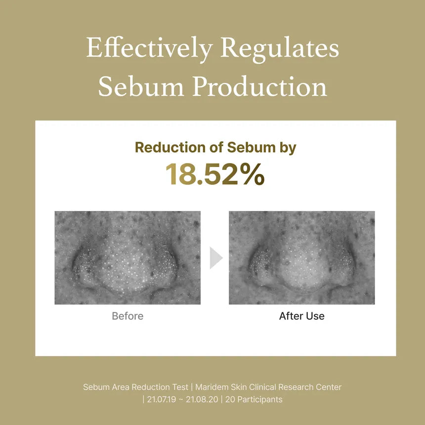 Advertisement showing reduction of sebum production with before and after images on a beige background.