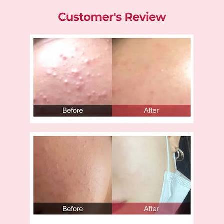 Before and after skin comparison on a pink background