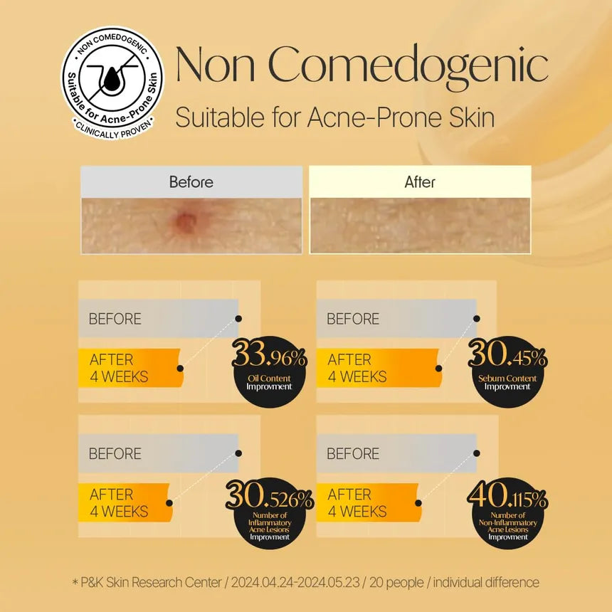 Before and after skin improvement results with percentages on a beige background