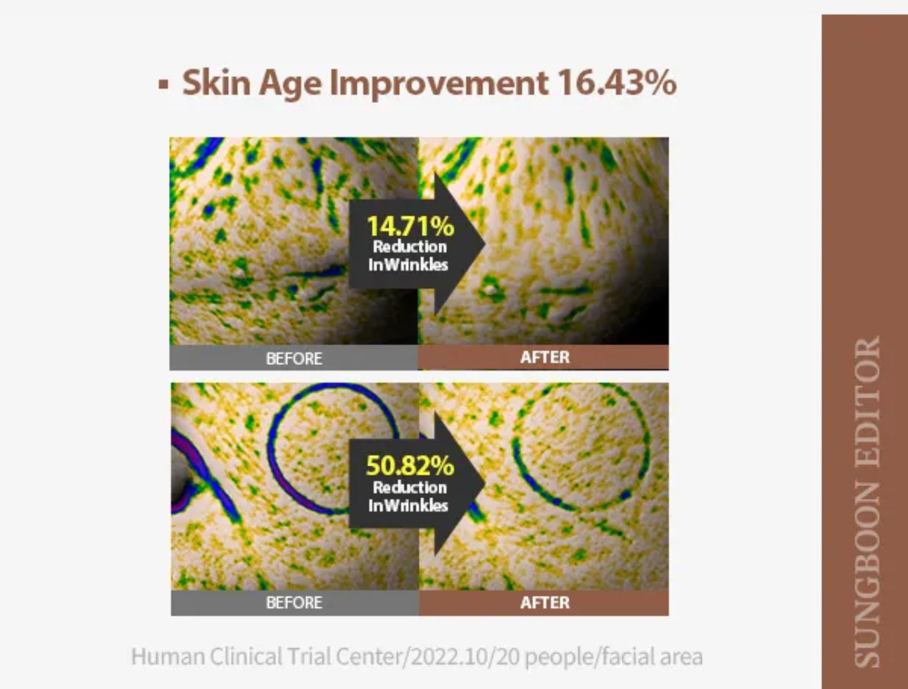 Before and after comparison of skin texture with wrinkle reduction statistics on a white background.